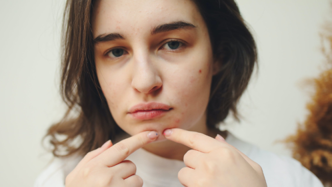 Light Therapy Pen: The New Weapon for Flawless Skin and Weight Loss!